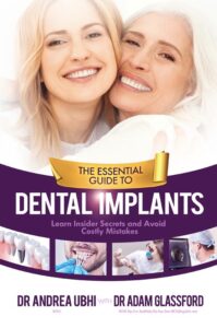 The Essential Guide to Dental Implants book by author Dr Andrea Ubi